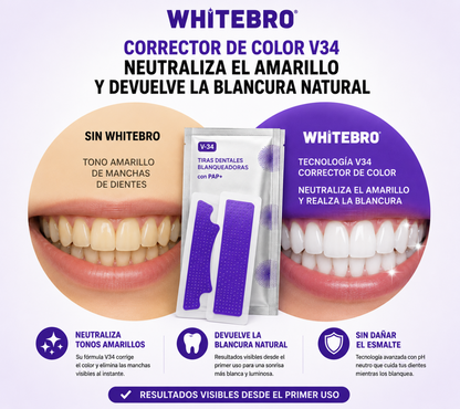 V34 SmileWhite