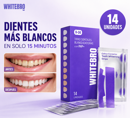 V34 SmileWhite